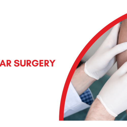 Vascular Surgery